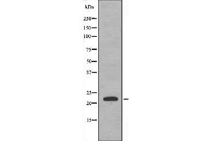 Western blot analysis of extracts from HepG2 cells, using TNFC antibody. (LTB 抗体  (C-Term))