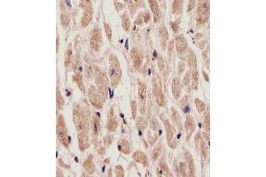 (ABIN6242180 and ABIN6577907) staining ADORA2A in Human heart tissue sections by Immunohistochemistry (IHC-P - paraformaldehyde-fixed, paraffin-embedded sections). (Adenosine A2a Receptor 抗体  (C-Term))