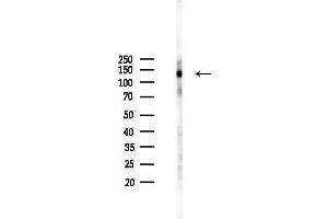 Western blot analysis of lysates from 293 cells(LPS 4h treatment), using Phospho-PYK2 (Tyr881) Antibody at 1/1000 dilution.