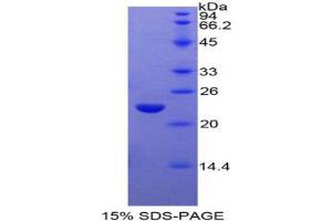 SDS-PAGE analysis of Rat GaA Protein. (GAA 蛋白)