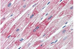 Human Heart (formalin-fixed, paraffin-embedded) stained with DBP antibody ABIN462166 followed by biotinylated goat anti-rabbit IgG secondary antibody ABIN481713, alkaline phosphatase-streptavidin and chromogen. (Vitamin D-Binding Protein 抗体  (AA 164-213))