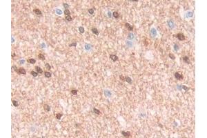 DAB staining on IHC-P; Samples: Human Cerebrum Tissue (QDPR 抗体  (AA 1-244))