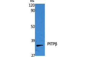 Western Blot (WB) analysis of specific cells using PITPbeta Polyclonal Antibody. (PITPNB 抗体  (Internal Region))