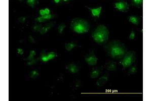 Immunofluorescence of monoclonal antibody to LFNG on HeLa cell. (LFNG 抗体  (AA 1-250))