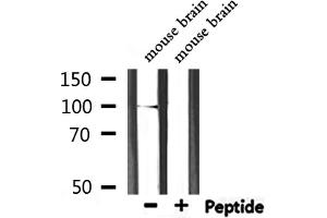 Western Blotting (WB) image for anti-Catenin (Cadherin-Associated Protein), alpha 1, 102kDa (CTNNA1) (C-Term) antibody (ABIN6260492)