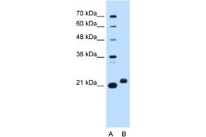 WB Suggested Anti-C1orf159 Antibody Titration:  0. (C1orf159 抗体  (Middle Region))