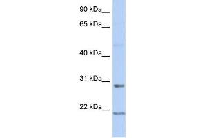 WB Suggested Anti-C12orf53 Antibody Titration: 0. (C12orf53 抗体  (Middle Region))