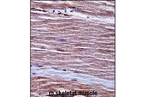 Mouse Acvr1 Antibody (Center) ((ABIN657718 and ABIN2846706))immunohistochemistry analysis in formalin fixed and paraffin embedded mouse skeletal muscle followed by peroxidase conjugation of the secondary antibody and DAB staining. (ACVR1 抗体  (AA 137-166))