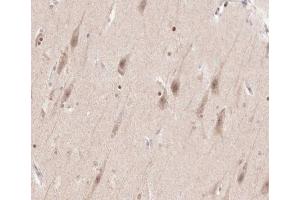 ABIN6266540 at 1/100 staining human brain tissue sections by IHC-P. (FGFR3 抗体  (C-Term))