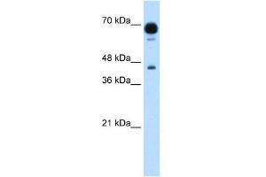 WB Suggested Anti-PUS7 Antibody Titration:  1. (PUS7 抗体  (N-Term))