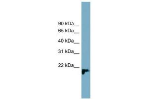 WB Suggested Anti-C1orf93 Antibody Titration: 0. (C1orf93 抗体  (Middle Region))