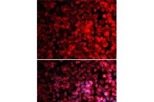 Immunofluorescence analysis of MCF7 cells using RPS10 Polyclonal Antibody (RPS10 抗体)