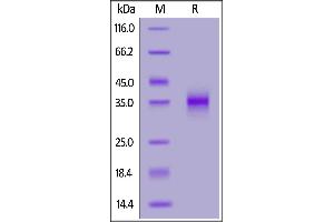Biotinylated SARS-CoV-2 Spike RBD (L452R), His,Avitag on  under reducing (R) condition. (SARS-CoV-2 Spike Protein (B.1.429 - epsilon, RBD) (His tag,AVI tag,Biotin))