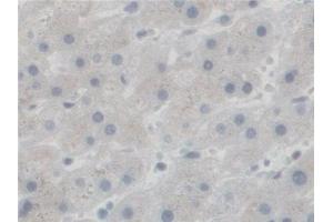 Immunohistochemistry (IHC) image for anti-N-Sulfoglucosamine Sulfohydrolase (SGSH) (AA 21-389) antibody (ABIN7436429)