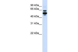 WB Suggested Anti-CYP3A43 Antibody Titration:  0. (CYP3A4 抗体  (C-Term))