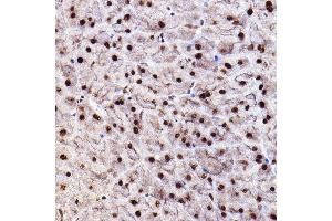 Immunohistochemistry of paraffin-embedded mouse pancreas using Phospho--S473+-S474+-S472 Rabbit pAb (ABIN7265523) at dilution of 1:100 (40x lens). (AKT 1/2/3 抗体  (pSer472))