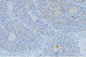 ABIN6268899 at 1/100 staining Human uterus tissue by IHC-P. (Gastrin 抗体  (C-Term))