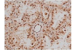 Immunohistochemistry (IHC) image for anti-Sp1 Transcription Factor (SP1) (pThr453) antibody (ABIN6256566)