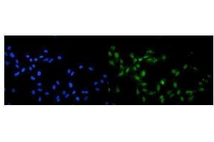 IF analysis of KAT13A/SRC1 using anti-KAT13A/SRC1 antibody (ABIN3042385).