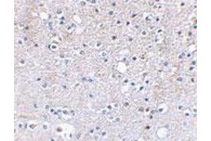 Immunohistochemical staining of human brain tissue using GRIK5 polyclonal antibody  at 2. (GRIK5 抗体  (C-Term))