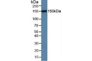 Detection of Slit1 in Mouse Serum using Polyclonal Antibody to Slit Homolog 1 (Slit1) (SLIT1 抗体  (AA 603-773))