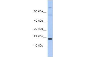 Host: Rabbit Target Name: HN1 Sample Type: Fetal Stomach lysates Antibody Dilution: 1.