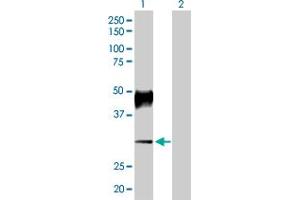 Western Blot analysis of ATP4B expression in transfected 293T cell line by ATP4B MaxPab polyclonal antibody.