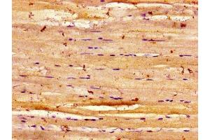 Immunohistochemistry of paraffin-embedded human skeletal muscle tissue using ABIN7150914 at dilution of 1:100 (Dysferlin 抗体  (AA 105-278))