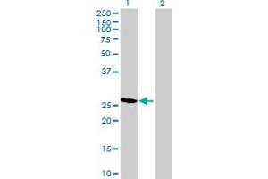 Western Blot analysis of RCAN2 expression in transfected 293T cell line by RCAN2 MaxPab polyclonal antibody. (RCAN2 抗体  (AA 1-225))