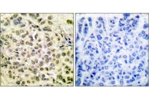 Immunohistochemistry (IHC) image for anti-CCAAT/enhancer Binding Protein (C/EBP), beta (CEBPB) (AA 201-250), (pThr235) antibody (ABIN1531213)