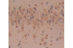 Used in DAB staining on fromalin fixed paraffin- embedded Kidney tissue (CD160 抗体  (AA 33-171))