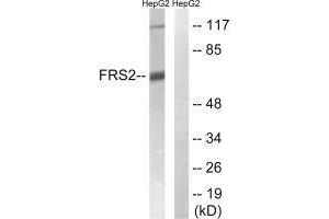 Western blot analysis of extracts from HepG2 cells, using FRS2 (Ab-196) antibody. (FRS2 抗体  (Tyr196))