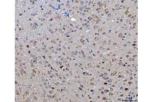 IHC analysis of ch TOG/CKAP5 using anti-ch TOG/CKAP5 antibody (ABIN6719294).