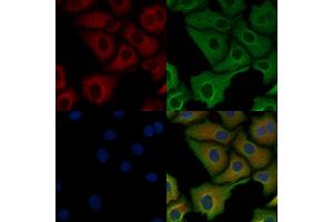 ABIN6263603 and ABIN6278495 staining Hela cells by IF/ICC. (Netrin 1 抗体  (C-Term))