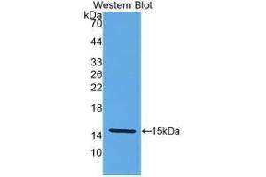Detection of Recombinant KLb, Human using Monoclonal Antibody to Klotho Beta (KLb) (Klotho beta 抗体  (AA 517-636))