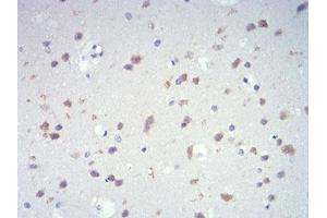 Immunohistochemistry (IHC) image for anti-Interleukin 28A (Interferon, lambda 2) (IL28A) (AA 1-200) antibody (ABIN5542627)