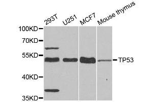Western blot analysis of extracts of various cell lines, using TP53 antibody. (p53 抗体  (C-Term))