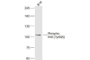 B16 lysates probed with Phospho-FAK (Tyr925) Polyclonal Antibody, Unconjugated  at 1:300 dilution and 4˚C overnight incubation. (FAK 抗体  (pTyr925))
