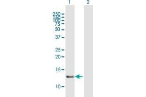 Western Blot analysis of SNRNP25 expression in transfected 293T cell line by SNRNP25 MaxPab polyclonal antibody. (SNRNP25 抗体  (AA 1-132))