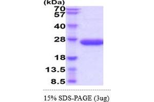 SDS-PAGE (SDS) image for Interleukin 6 (IL6) (AA 25-211) (Active) protein (His tag) (ABIN5855052)