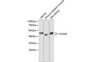 Western blot analysis of extracts of various cell lines, using KCNJ4 antibody (ABIN6134096, ABIN6142734, ABIN6142737 and ABIN6218214) at 1:1000 dilution. (KCNJ4 抗体  (AA 50-150))