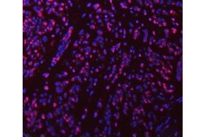IF analysis of SART1 using anti-SART1 antibody (ABIN7599884).