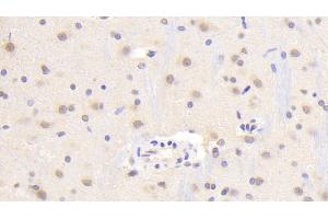 Detection of TREM2 in Rat Cerebrum Tissue using Polyclonal Antibody to Triggering Receptor Expressed On Myeloid Cells 2 (TREM2) (TREM2 抗体  (AA 1-228))