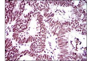 Immunohistochemistry (IHC) image for anti-Ring Finger Protein 1 (RING1) (AA 79-263) antibody (ABIN1845880) (RING1 抗体  (AA 79-263))