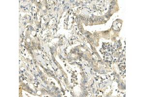 IHC analysis of BubR1/BUB1B using anti-BubR1/BUB1B antibody (ABIN7600960). (BUB1B 抗体  (AA 26-448))