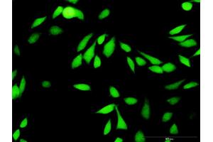 Immunofluorescence of purified MaxPab antibody to XIAP on HeLa cell. (XIAP 抗体  (AA 1-497))