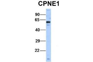 Host:  Rabbit  Target Name:  CPNE1  Sample Type:  Human Hela  Antibody Dilution:  1. (CPNE1 抗体  (Middle Region))