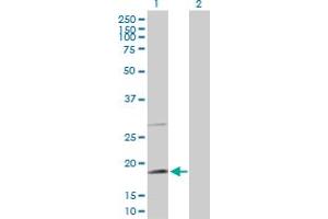 Western Blot analysis of TAF8 expression in transfected 293T cell line by TAF8 MaxPab polyclonal antibody. (TAF8 抗体  (AA 1-174))