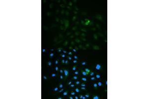 Immunofluorescence analysis of MCF7 cell using CD79B antibody. (CD79b 抗体  (AA 29-159))