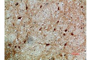 Immunohistochemical analysis of paraffin-embedded human-brain, antibody was diluted at 1:200 (NFAT5 抗体  (AA 1268-1341))